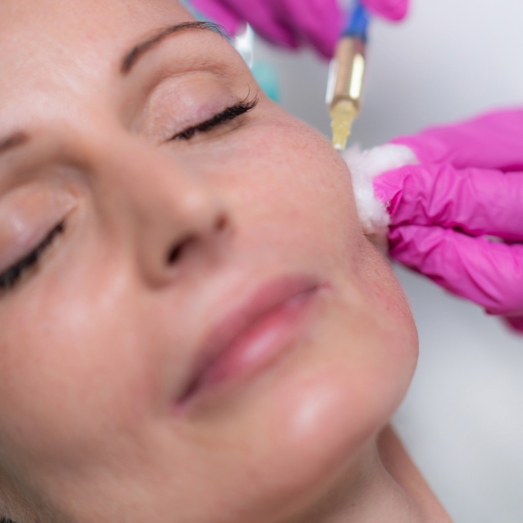 Dermal fillers treatment featured image medisculpt